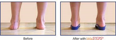 ls soft knee braces for pain relief